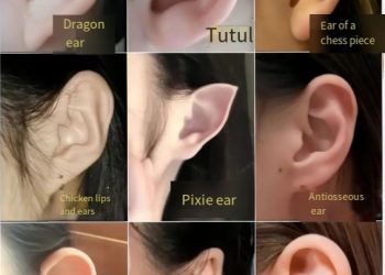 Ear Shape: Understanding, Concerns, and Surgical Solutions