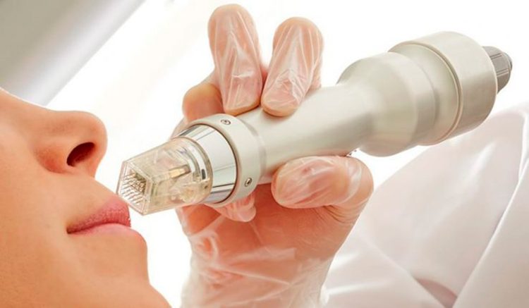 Gold microneedles: Innovative therapies for skin repair and anti-aging