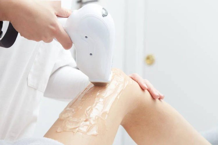 What is the principle of laser hair removal, suitable for which skin types of people?