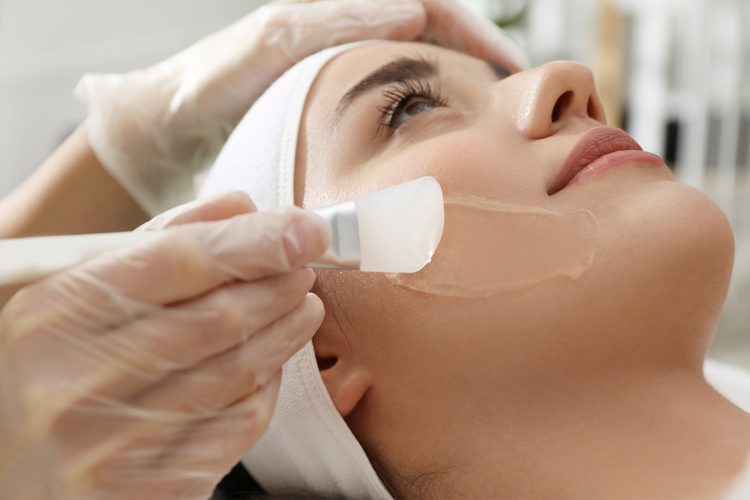 Chemical Peels: How They Work and Why They’re Still Popular