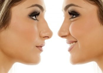 Rhinoplasty: Is the Nose Job Procedure Right for You?