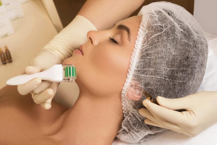 The Secret Behind Microneedling: Can It Really Transform Your Skin?