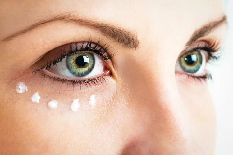 How to Get Rid of Dark Circles Under Your Eyes