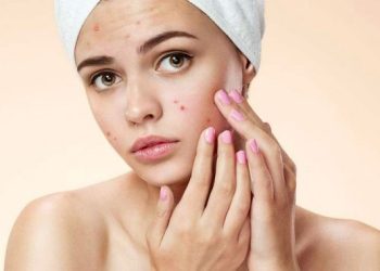 Effective Acne Treatment Products for Acne-Prone Skin While Maintaining Skin Health