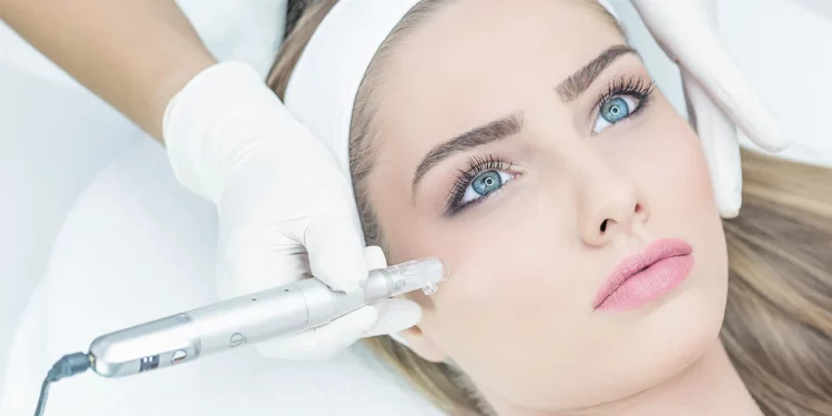 How Does PRP Microneedling Work to Revive Your Skin’s Vitality?