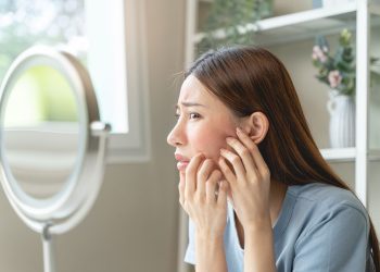 Can Stress Cause Breakouts? How to Handle It?