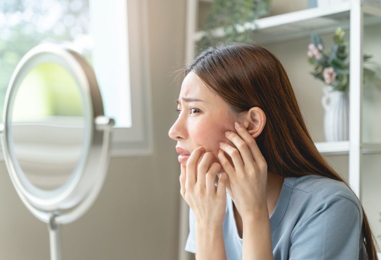 Can Stress Cause Breakouts? How to Handle It?