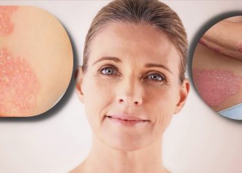 How Do Sleep and Stress Affect Your Beauty Routine?