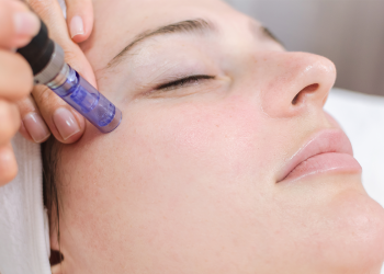 What’s the Real Impact of Microneedling on Your Skin?