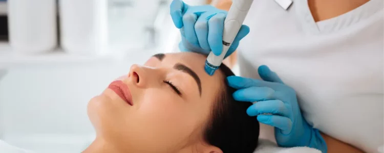How Does Microneedling Stimulate Collagen Production? Which Skin Issues Does It Address?