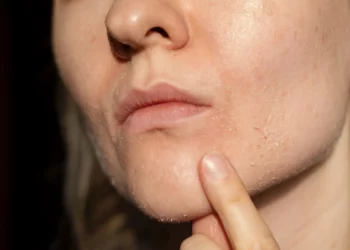 Essential Steps for Daily Skincare Routine for Dry Skin