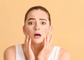 The Acne Battle: Is It Better to Choose Acne Serums or Gentle Cleansers? The Truth Revealed!