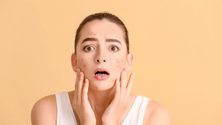 The Acne Battle: Is It Better to Choose Acne Serums or Gentle Cleansers? The Truth Revealed!