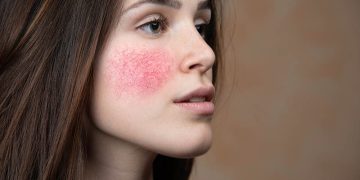 Sensitive Skin Skincare Mistakes: Are You Unknowingly Damaging Your Skin?
