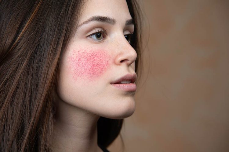 Sensitive Skin Skincare Mistakes: Are You Unknowingly Damaging Your Skin?