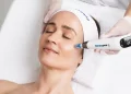 Microneedling: Can It Truly Revitalize Your Skin? Discover Its Real Results and Potential Risks!