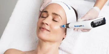 Microneedling: Can It Truly Revitalize Your Skin? Discover Its Real Results and Potential Risks!