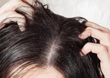 Is Your Scalp the Root Cause of Your Hair Problems?