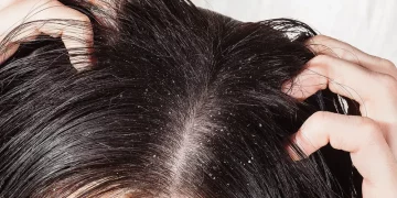 Is Your Scalp the Root Cause of Your Hair Problems?