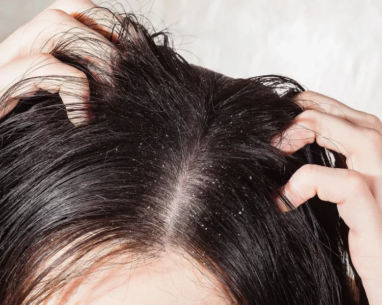 Is Your Scalp the Root Cause of Your Hair Problems?
