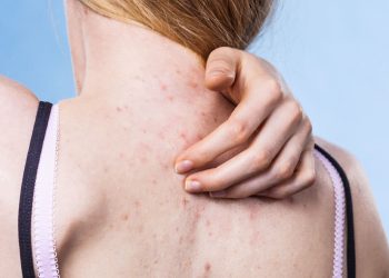 Is Your Active Lifestyle Helping Your Fitness But Hurting Your Skin?