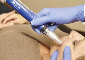 Microneedling: How Can Tiny Needles Revolutionize Your Skin?
