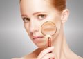 How Can You Effectively Treat Post-Inflammatory Hyperpigmentation and Prevent Future Spots?