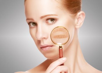 How Can You Effectively Treat Post-Inflammatory Hyperpigmentation and Prevent Future Spots?