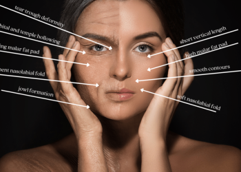 What Should You Know About Non-Surgical Cheek Augmentation Before Choosing It?