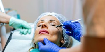 Can Cosmetic Ear Reshaping Be Achieved Without Surgery?