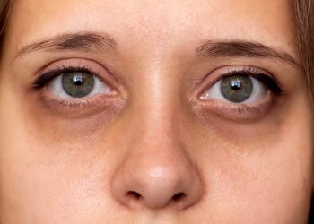 How Can You Master the Art of Color-Correcting in Makeup?