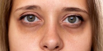 How Can You Master the Art of Color-Correcting in Makeup?