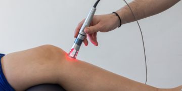 What Causes Hyperpigmentation and How Can You Effectively Treat It?