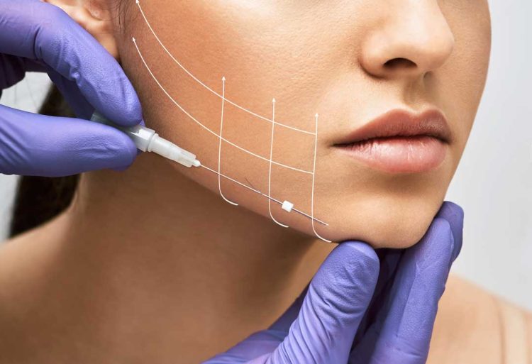 Is Thread Lifting a Safe Alternative to Facelift Surgery?