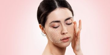 Thread Lifts vs Traditional Facelifts: Which Option Is Right for You?