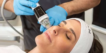 Is Microneedling with Serums Really Safe—and How Do You Maximize Its Results?