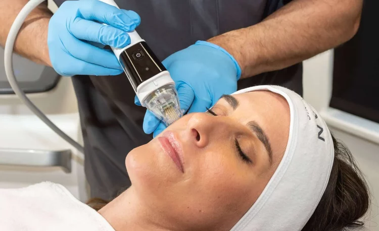 Is Microneedling with Serums Really Safe—and How Do You Maximize Its Results?