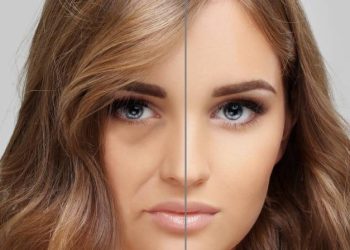 The Hydration vs. Volume Debate: Demystifying Skin Boosters and Fillers