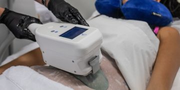 Which Body Contouring Technology Is Right for You: Fat Freezing, Radiofrequency, or Ultrasound?