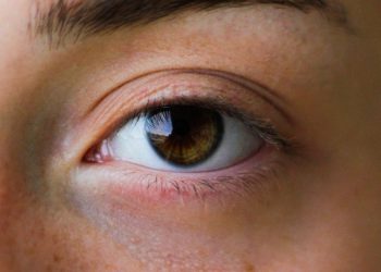 Can Stress Actually Cause Hair Loss?