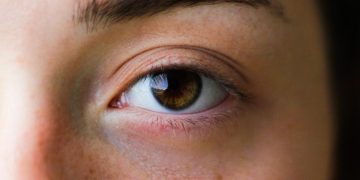 Can Stress Actually Cause Hair Loss?