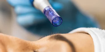 From Needles to Nanotech: The Evolution of Skin Rejuvenation Treatments